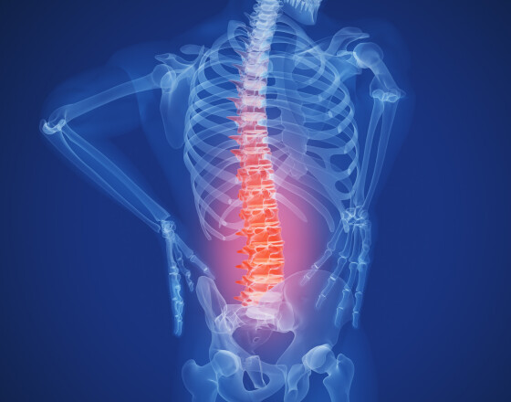 Back pain acupuncture